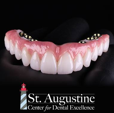 Hybrid Implant Bridge